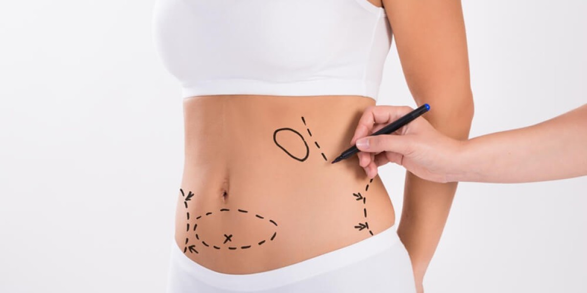 Liposuction Clinics and Accreditation Ensuring Safety Standards