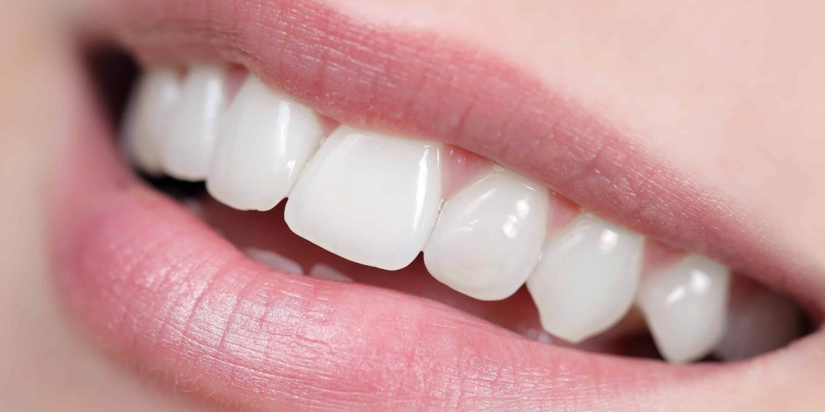 Children's Adult Teeth Restoration: The Role of Dental Implants in Hertfordshire
