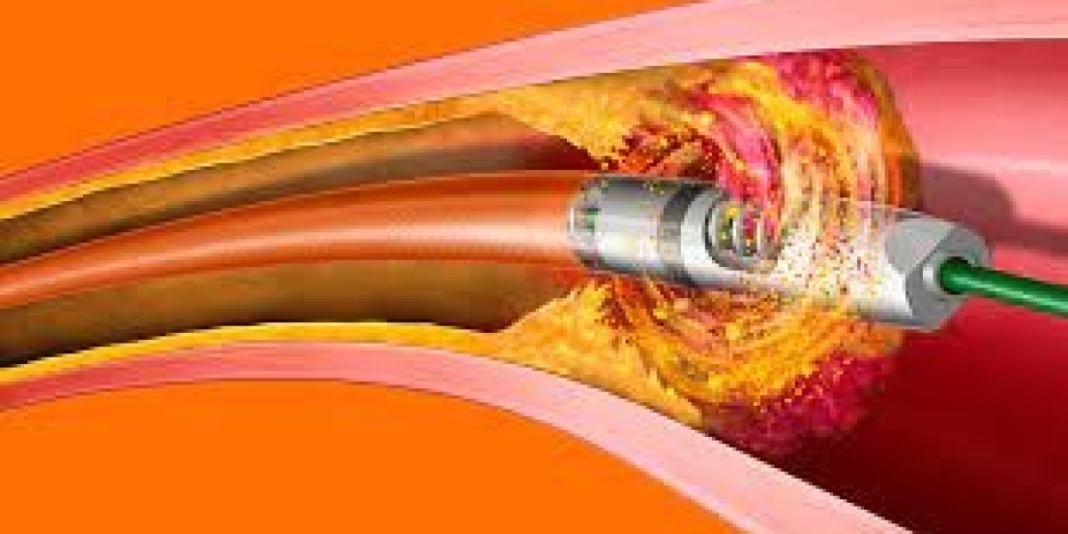 Atherectomy Devices Market, Size, Share, Global Forecast 2023-2030