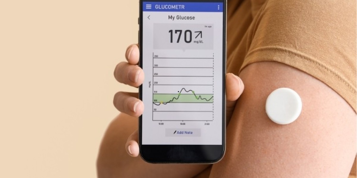 Continuous Glucose Monitoring Market will be US$ 13.06 Billion by 2032