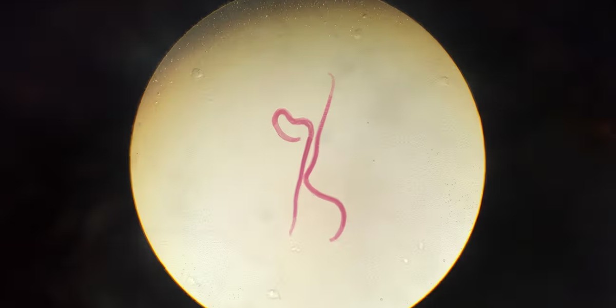 How to Protect Yourself from Parasitic Worms?